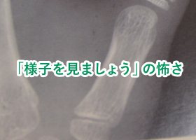 「様子を見ましょう」の怖さ